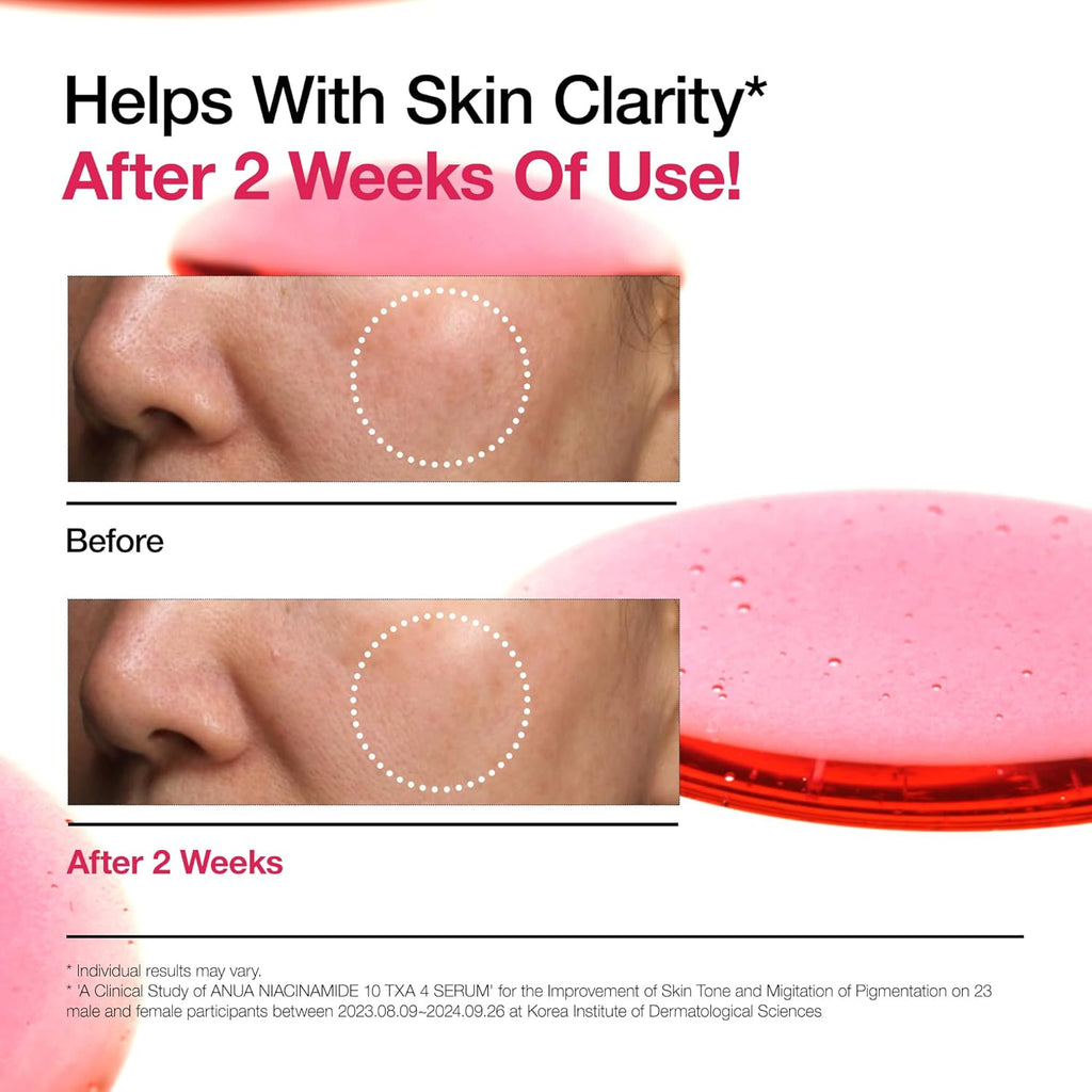 [ Acne Scar & Dark Spot Treatment Kit] – Korean Niacinamide Serum & Soothing Cream for Hyperpigmentation