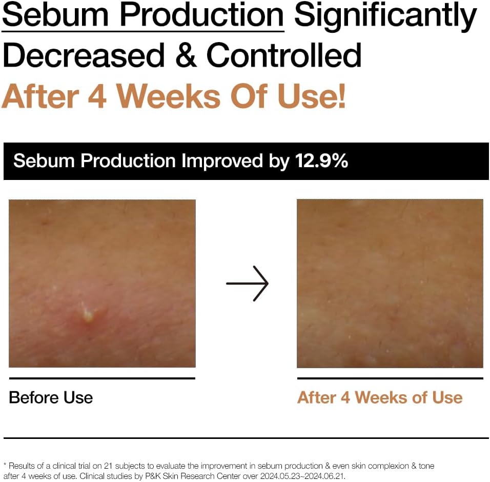 [ANUA]- Brightening & Pigmentation Care Set – Rice Toner + Cleanser (Korean Skincare Pakistan)