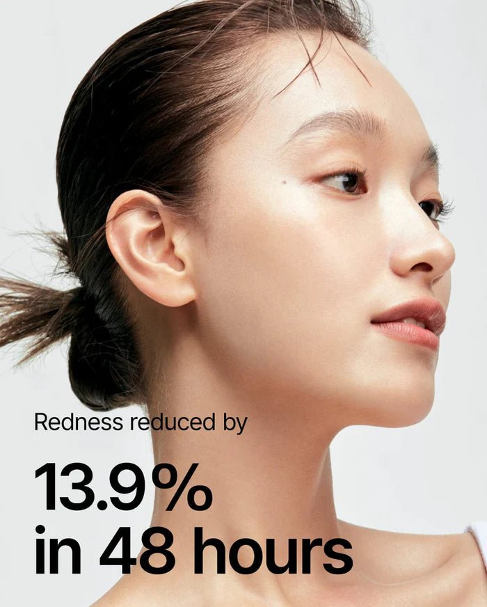 [ANUA] - HEARTLEAF 77% SOOTHING TONER – For Sensitive skin- 100% Authentic Korean Skincare in Pakistan