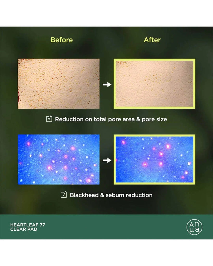 [ANUA] - Heartleaf 77% Toner Clear Pad 70EA – 100% Authentic Korean Skincare in Pakistan