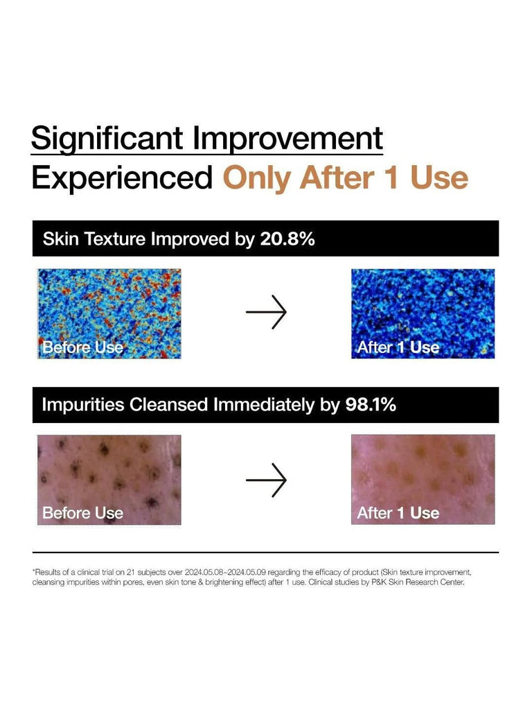 [ANUA] Rice Enzyme Brightening Cleansing Powder 40g – 100% Authentic Korean Skincare in Pakistan