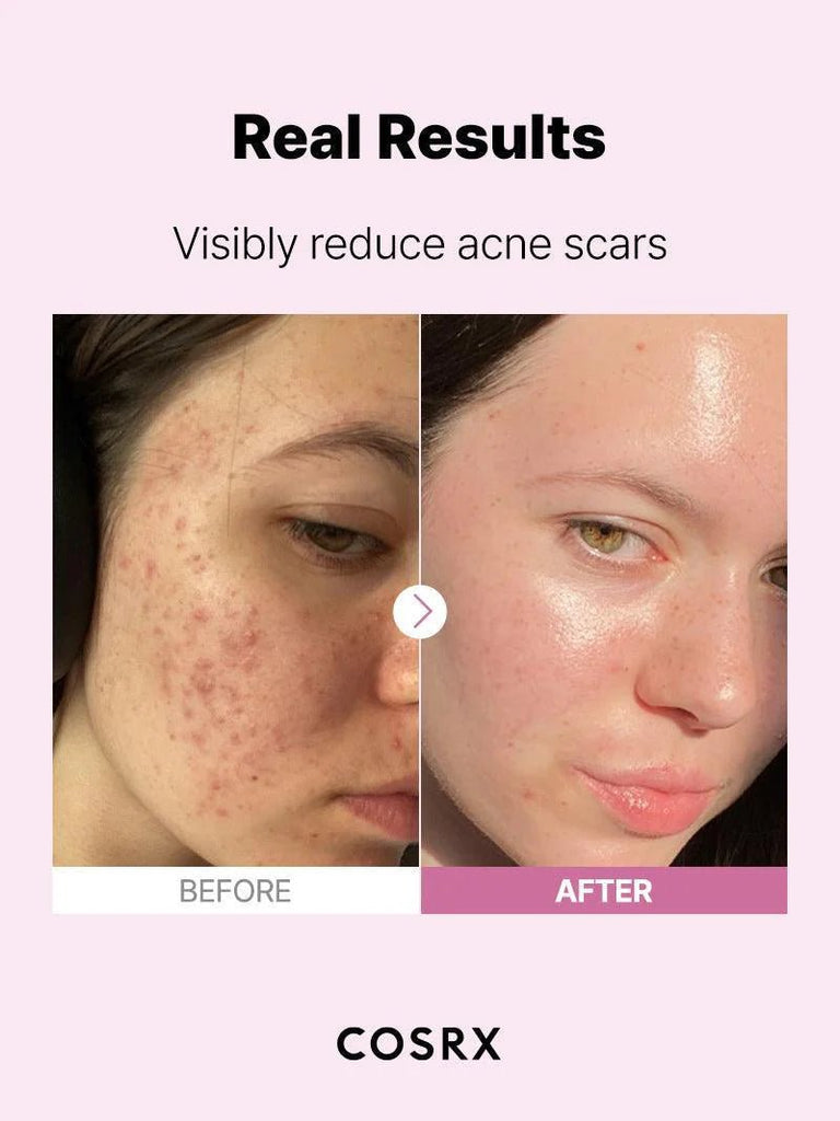 [COSRX] The Niacinamide 15 Serum 20ml – for Acne, Dark Spots | 100% Authentic Korean Skincare in Pakistan